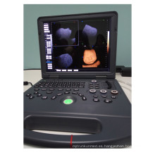 Ordenador portátil 3D y 4D Ultrasound Machine Price &amp; DAWEI DWC60 color Doppler